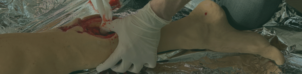 Baziniai kraujavimo stabdymo mokymai (Stop The Bleed)